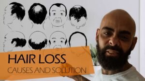 Hair Loss Causes and Solutions