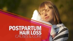 Postpartum Hair Loss: Causes & Cope